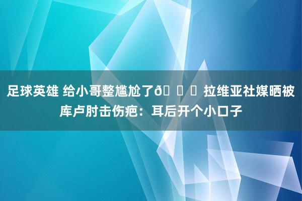 足球英雄 给小哥整尴尬了😅拉维亚社媒晒被库卢肘击伤疤：耳后开个小口子